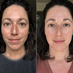 Parches PuraDerma™  - Reduce las ojeras