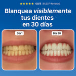 Odontic™ – Tu Sonrisa Más Limpia, Fuerte y Saludable