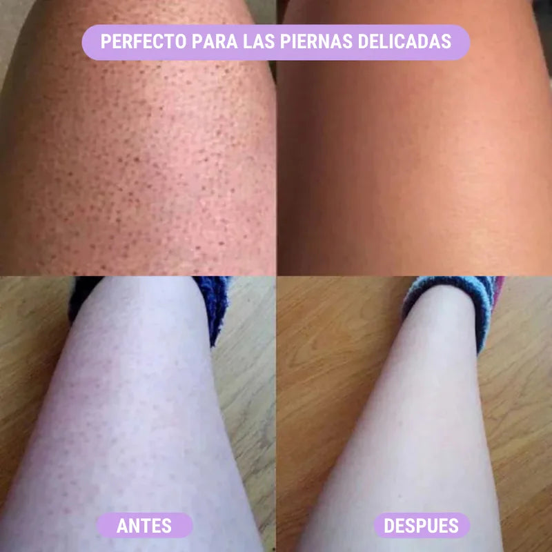 🔥 DEBLAST™ 2X1 – PIDE 2, PAGA 1: DEPILACIÓN LÁSER EN CASA 🏠